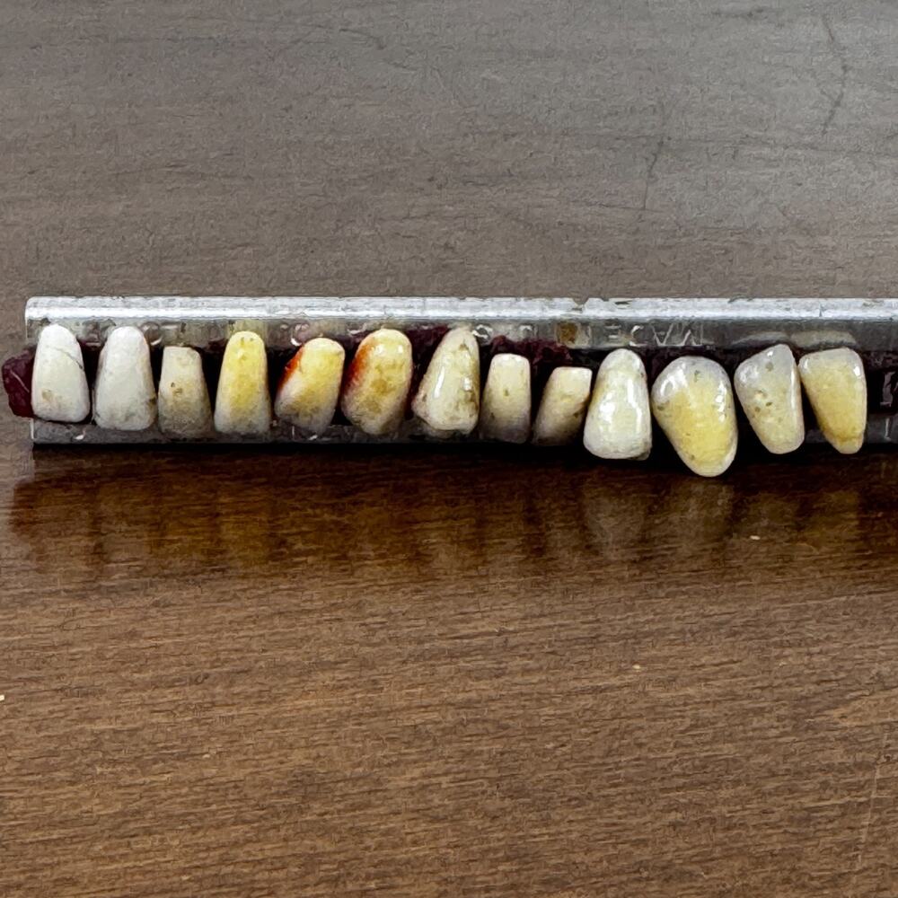 Antique Dental Tooth Shade Guide Porcelain Teeth S.S. White Mfg Co Vintage
